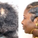 Relaxing hair can cause alopecia, expert warns